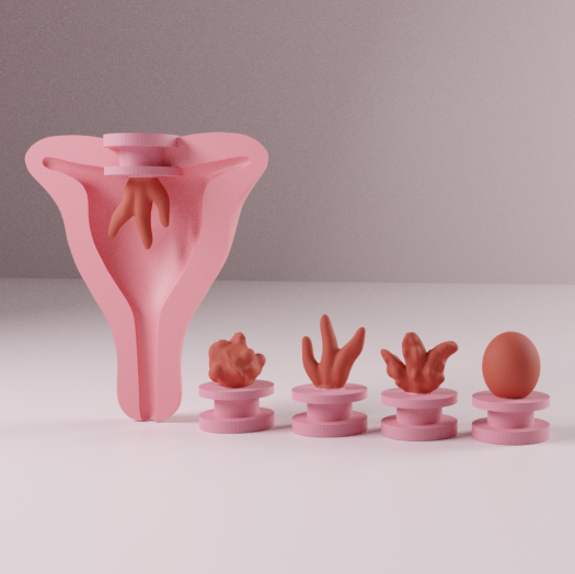 Uterine-Polyps_in-uterus